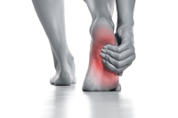 Heel Fat Pad Syndrome and Its Impact on Foot Health